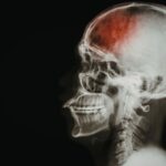 Catastrophic Injury Lawyers in Mesa image