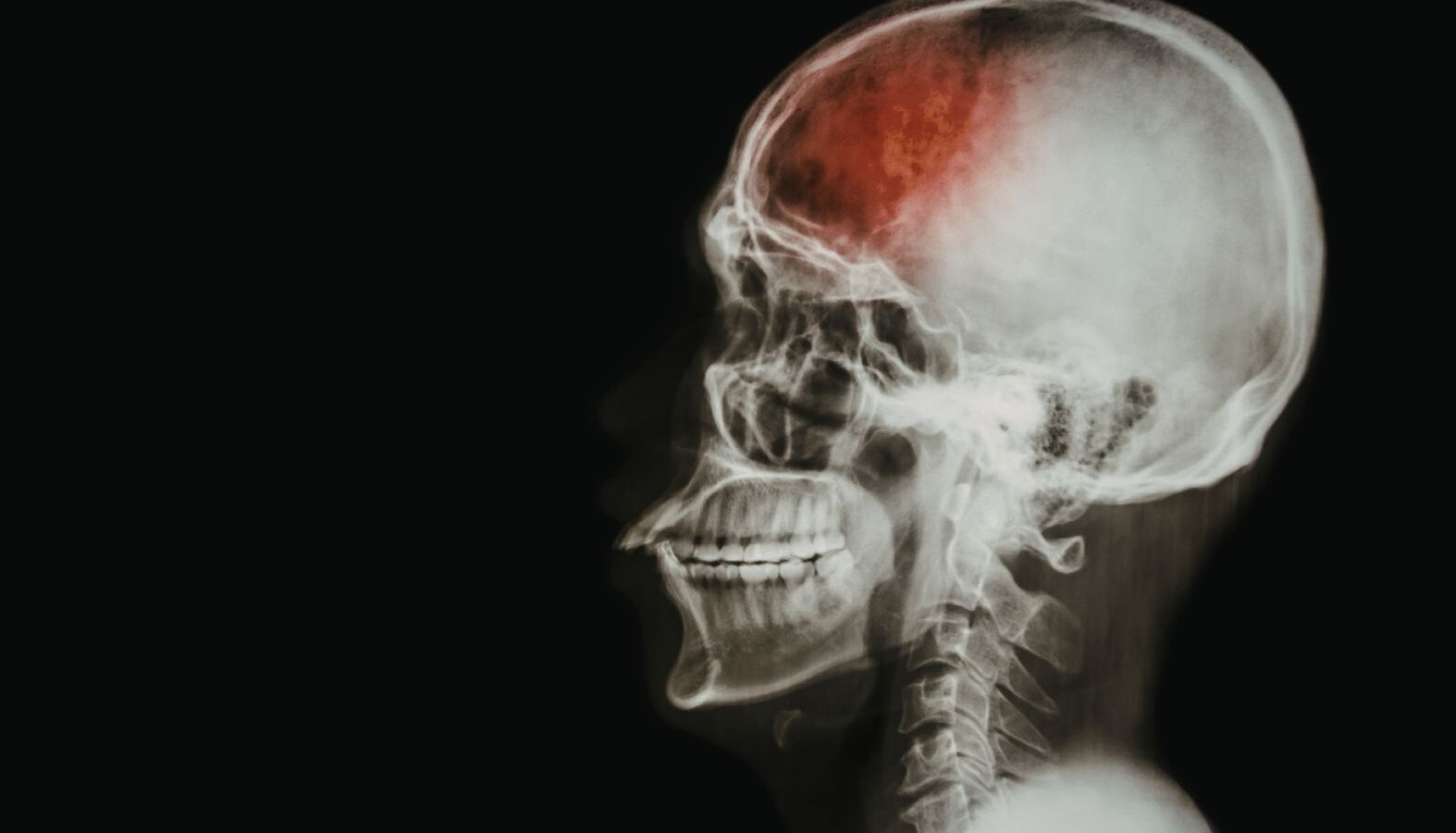 Catastrophic Injury Lawyers in Mesa image